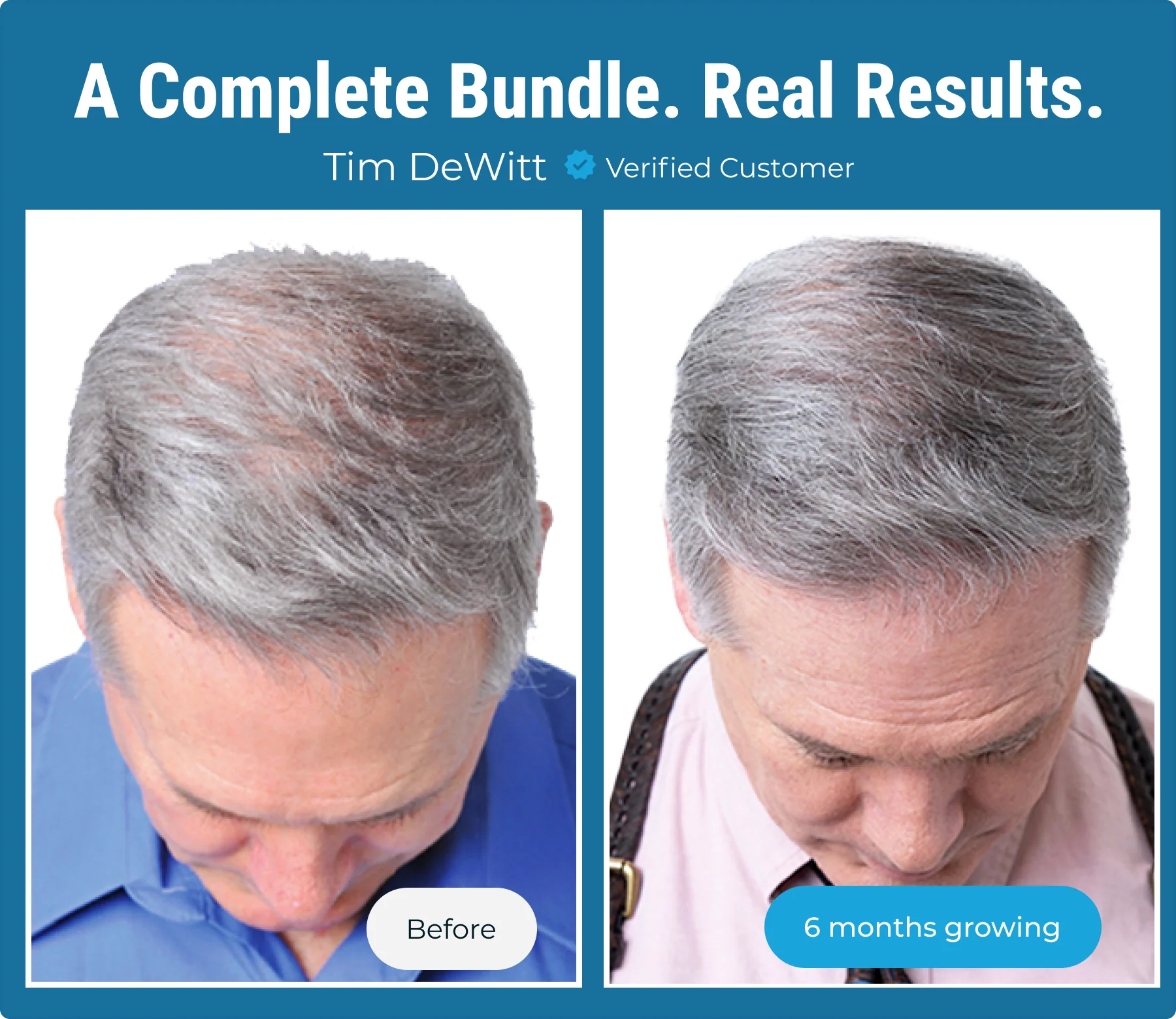 Complete Hair Growth Bundle - Image 14
