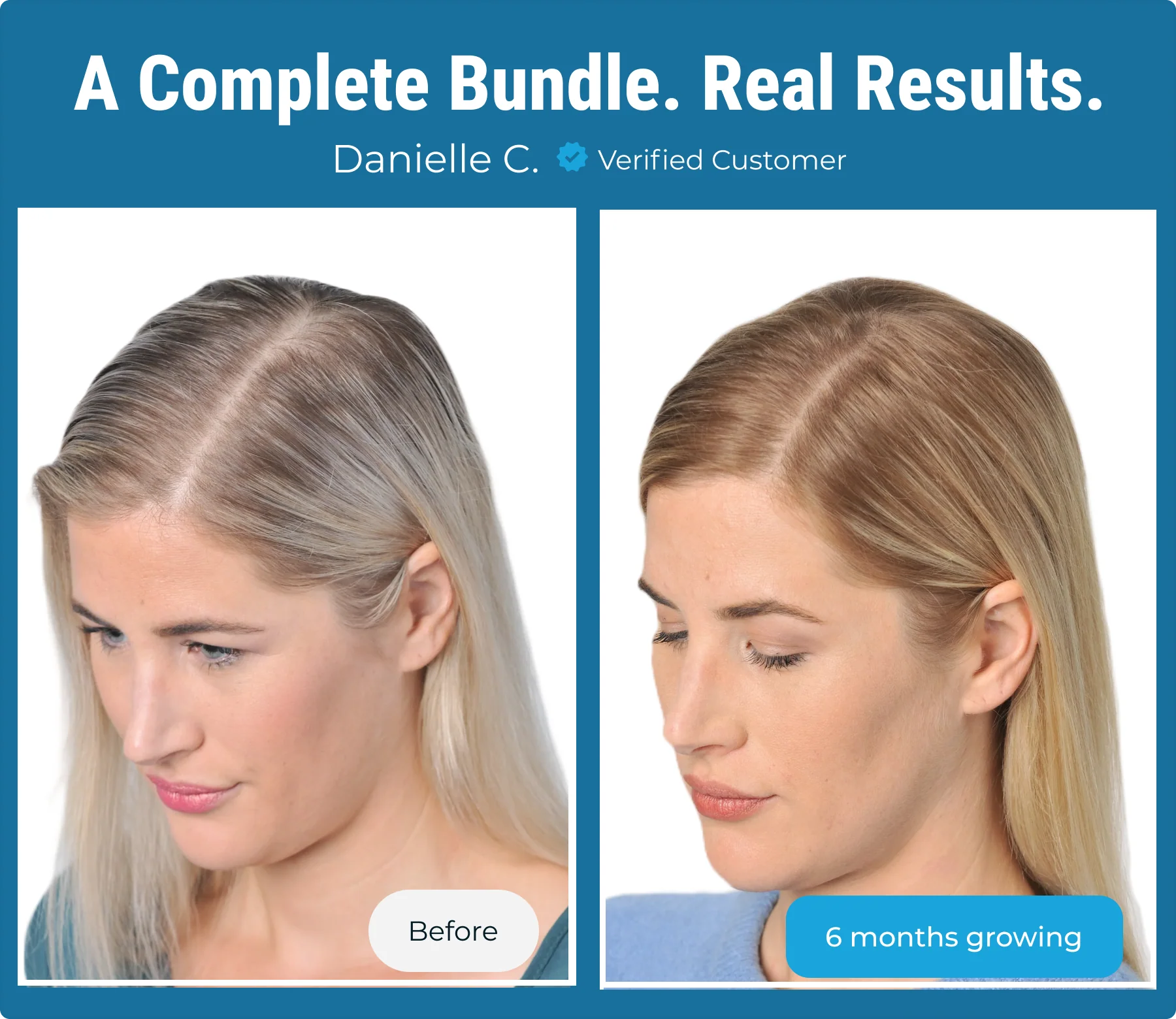 Complete Hair Growth Bundle - Image 15